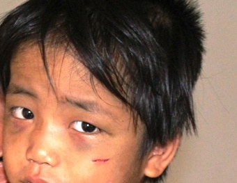 Cháu bé 3 tuổi bị đánh đập, bắt ăn xin: Gia đình vô tâm!